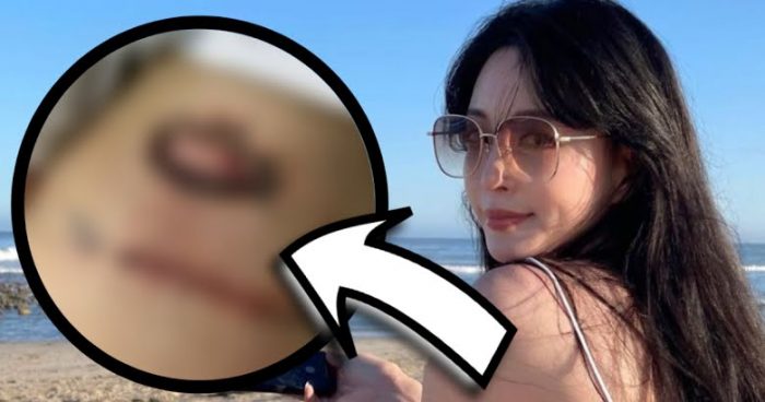 Фанаты заметили шрам актрисы Хан Е Сыль, который она получила в результате инцидента в 2018 году