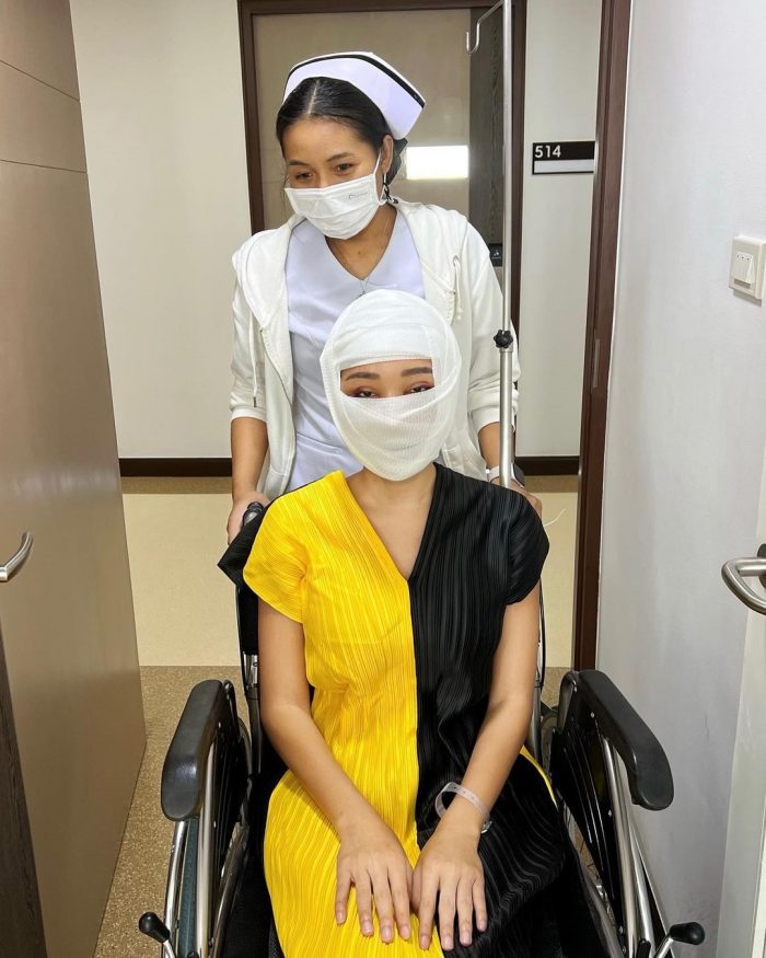 Индонезийский инфлюенсер сделала косметическую операцию, чтобы выглядеть, как Лиса из BLACKPINK
