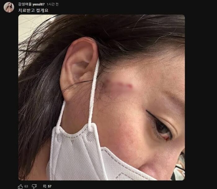 Корейский стример ударила коллегу вилкой в прямом эфире