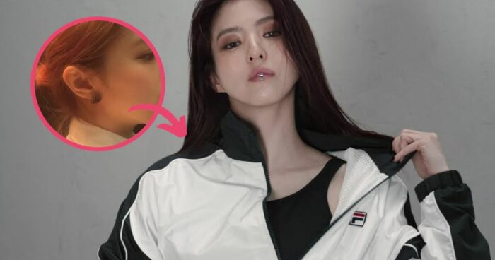 Актриса Хан Со Хи перенесла операцию на носу