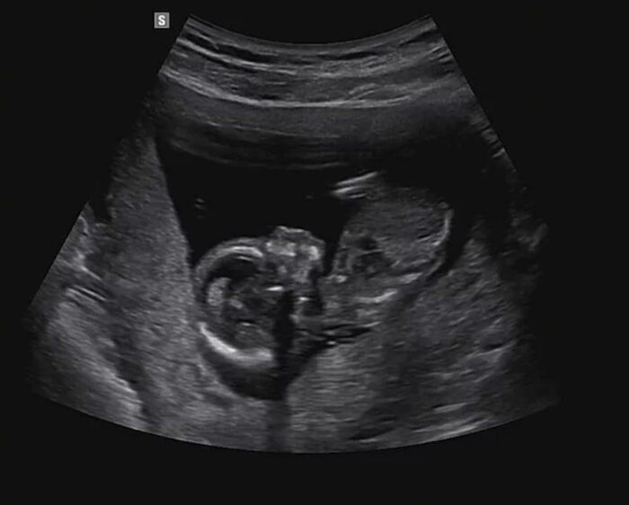 Хун из U-KISS объявил, что станет отцом