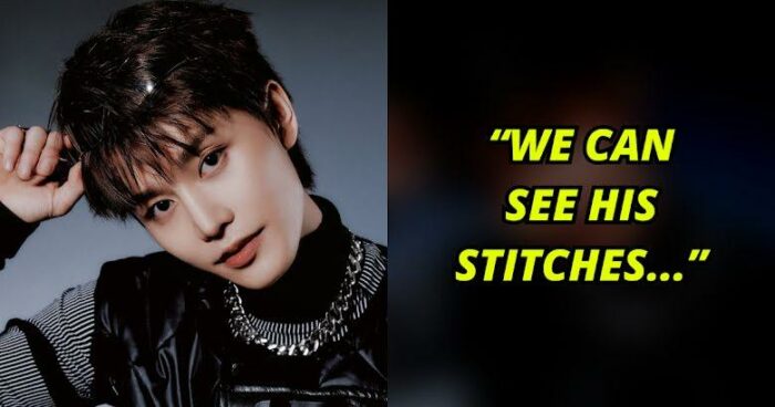 SM Entertainment выложили и удалили тизерное фото Тэиля из NCT, показавшее его травму - фанаты недовольны