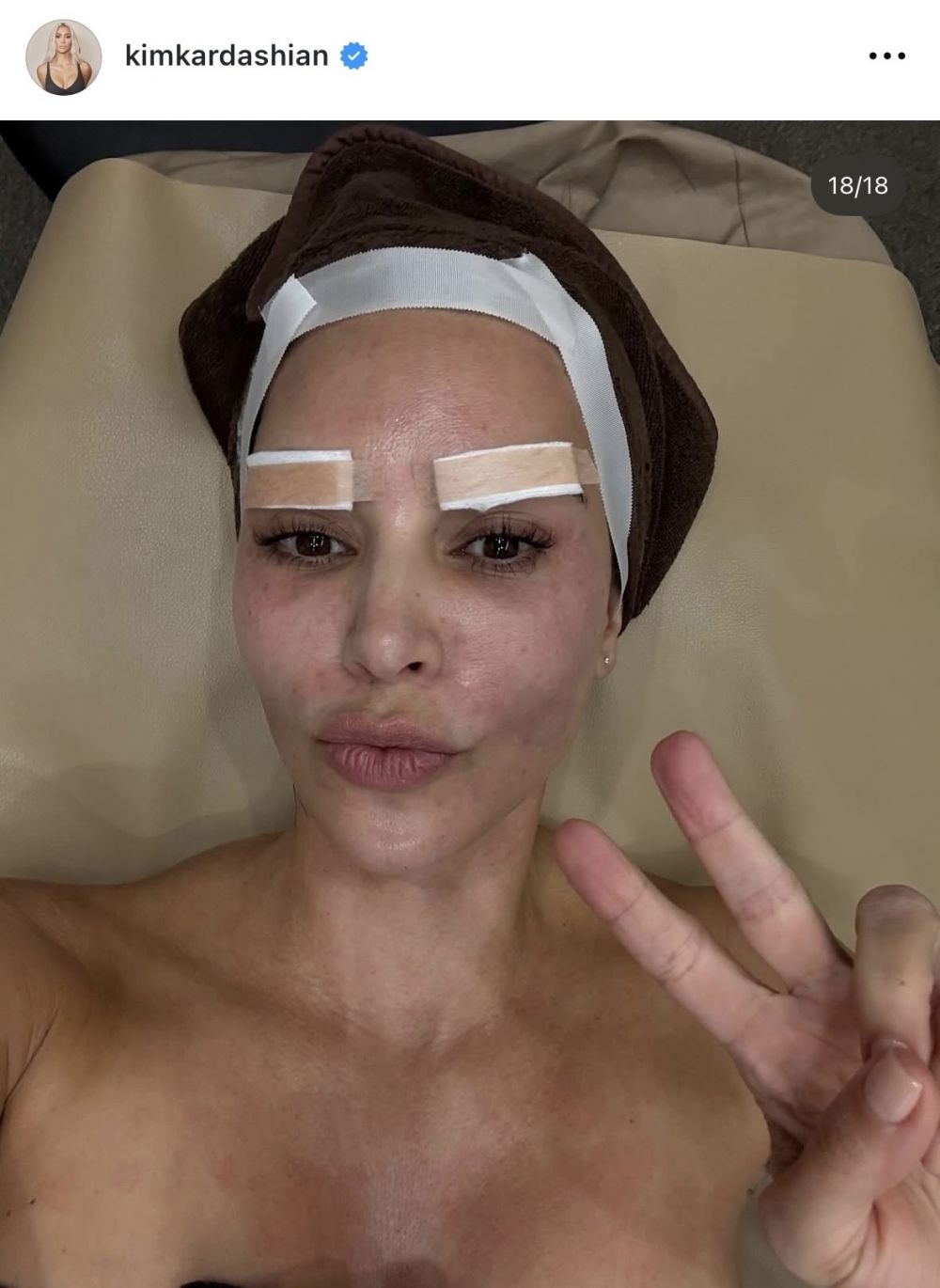 Ким Кардашьян прошла косметическую процедуру в Корее, вызвав оживлённые обсуждения среди корейских нетизенов